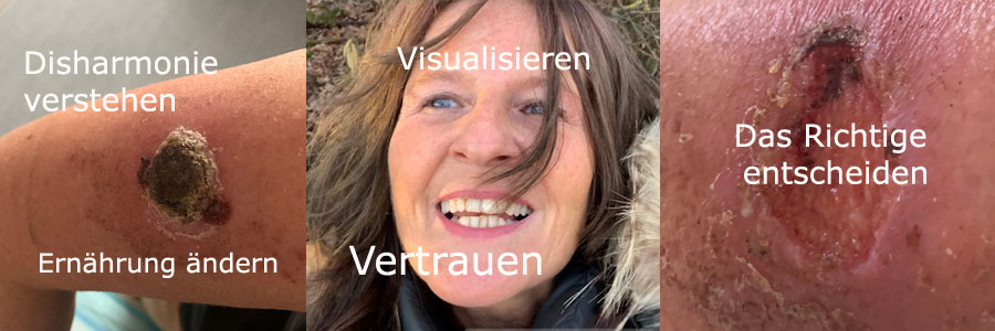 Erfahrungsbericht Tumor