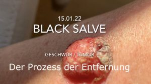 Dailymotion Video Vorschau