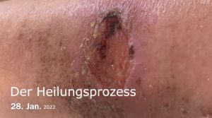 Dailymotion Video Vorschau