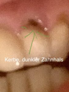 Zahngesundheit Hydroxyapatite